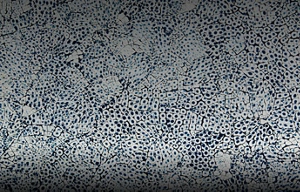 A close up of the Eggshell Snakeskin Sapphire